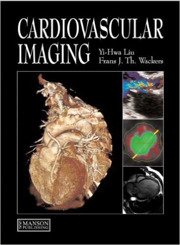 free-pdf-download-Cardiovascular Imaging