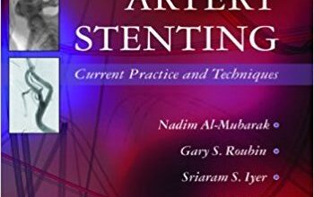 free-pdf-download-Carotid Artery Stenting: Current Practice and Techniques 1st Edition