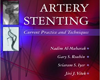 free-pdf-download-Carotid Artery Stenting: Current Practice and Techniques 1st Edition