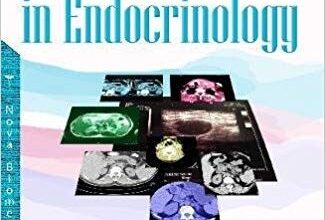 free-pdf-download-Case Discussions in Endocrinology