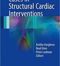 free-pdf-download-Cases in Structural Cardiac Intervention 1st ed. 2017 Edition