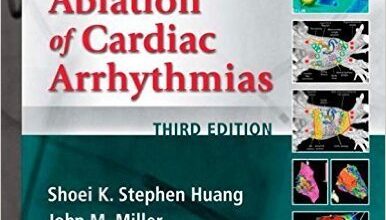 free-pdf-download-Catheter Ablation of Cardiac Arrhythmias