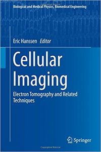 free-pdf-download-Cellular Imaging: Electron Tomography and Related Techniques (Biological and Medical Physics