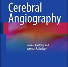 free-pdf-download-Cerebral Angiography: Normal Anatomy and Vascular Pathology