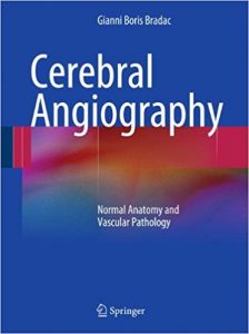 free-pdf-download-Cerebral Angiography: Normal Anatomy and Vascular Pathology