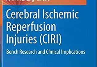 free-pdf-download-Cerebral Ischemic Reperfusion Injuries (CIRI): Bench Research and Clinical Implications 1st ed. 2018 Edition