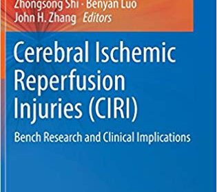 free-pdf-download-Cerebral Ischemic Reperfusion Injuries (CIRI): Bench Research and Clinical Implications 1st ed. 2018 Edition