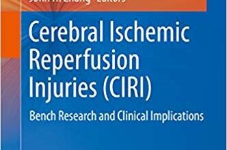 free-pdf-download-Cerebral Ischemic Reperfusion Injuries (CIRI): Bench Research and Clinical Implications