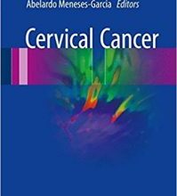 free-pdf-download-Cervical Cancer 1st ed. 2017 Edition