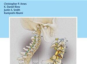 free-pdf-download-Cervical Spine Deformity Surgery