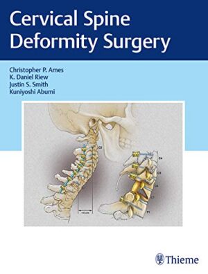 free-pdf-download-Cervical Spine Deformity Surgery