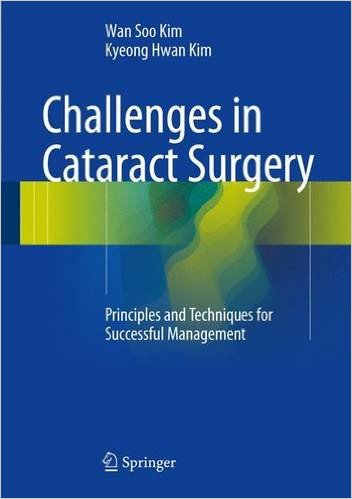 free-pdf-download-Challenges in Cataract Surgery: Principles and Techniques for Successful Management 1st ed. 2016 Edition