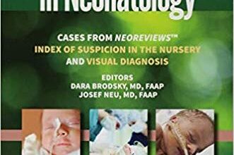 free-pdf-download-Challenging Cases in Neonatology: Cases from NeoReviews “Index of Suspicion in the Nursery” and “Visual Diagnosis” First Edition