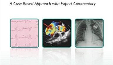 free-pdf-download-Challenging Concepts in Cardiovascular Medicine: Cases with Expert Commentary 1st Edition