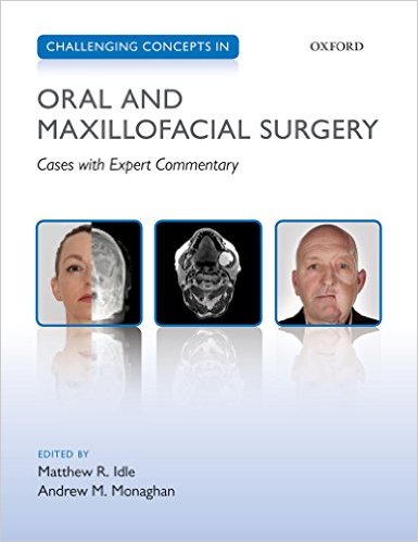 free-pdf-download-Challenging Concepts in Oral and Maxillofacial Surgery: Cases with Expert Commentary 1st Edition