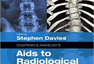 free-pdf-download-Chapman & Nakielny’s Aids to Radiological Differential Diagnosis: Expert Consult – Online and Print