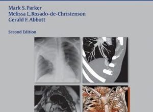 free-pdf-download-Chest Imaging Case Atlas 2nd Edition