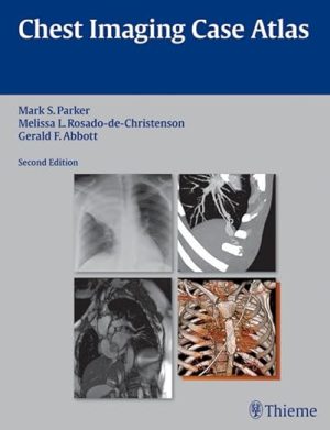 free-pdf-download-Chest Imaging Case Atlas 2nd Edition