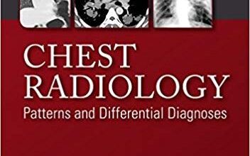 free-pdf-download-Chest Radiology: Patterns and Differential Diagnoses