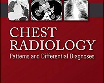 free-pdf-download-Chest Radiology: Patterns and Differential Diagnoses