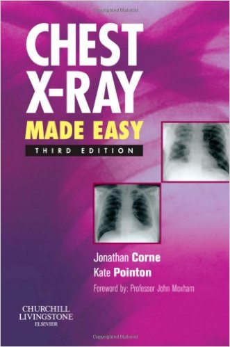 free-pdf-download-Chest X-Ray Made Easy