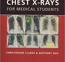 free-pdf-download-Chest X-rays for Medical Students 1st Edition