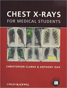 free-pdf-download-Chest X-rays for Medical Students 1st Edition