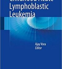 free-pdf-download-Childhood Acute Lymphoblastic Leukemia 1st ed. 2017 Edition