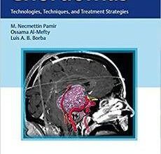 free-pdf-download-Chordomas: Technologies