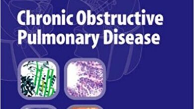 free-pdf-download-Chronic Obstructive Pulmonary Disease 1st Edition