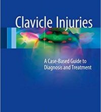 free-pdf-download-Clavicle Injuries: A Case-Based Guide to Diagnosis and Treatment 1st ed. 2018 Edition