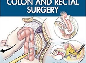 free-pdf-download-Cleveland Clinic Illustrated Tips and Tricks in Colon and Rectal Surgery