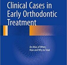 free-pdf-download-Clinical Cases in Early Orthodontic Treatment: An Atlas of When