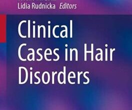 free-pdf-download-Clinical Cases in Hair Disorders