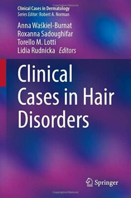 free-pdf-download-Clinical Cases in Hair Disorders