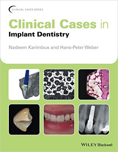 free-pdf-download-Clinical Cases in Implant Dentistry (Clinical Cases (Dentistry))