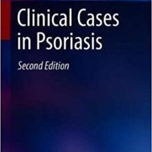 free-pdf-download-Clinical Cases in Psoriasis (Clinical Cases in Dermatology) 2nd ed