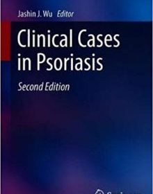 free-pdf-download-Clinical Cases in Psoriasis (Clinical Cases in Dermatology) 2nd ed