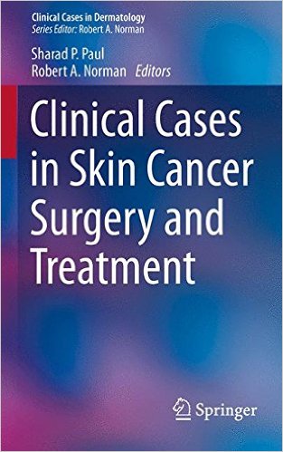 free-pdf-download-Clinical Cases in Skin Cancer Surgery and Treatment (Clinical Cases in Dermatology) 1st ed. 2016 Edition