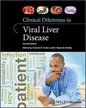 free-pdf-download-Clinical Dilemmas in Viral Liver Disease 2nd Edition