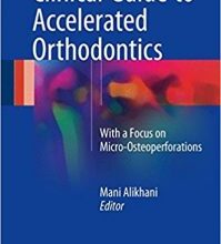 free-pdf-download-Clinical Guide to Accelerated Orthodontics: With a Focus on Micro-Osteoperforations 1st ed