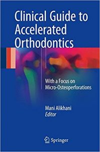 free-pdf-download-Clinical Guide to Accelerated Orthodontics: With a Focus on Micro-Osteoperforations 1st ed