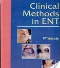 free-pdf-download-Clinical Methods in ENT