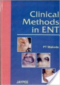 free-pdf-download-Clinical Methods in ENT