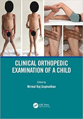 free-pdf-download-Clinical Orthopedic Examination of a Child