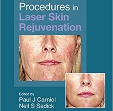 free-pdf-download-Clinical Procedures in Laser Skin Rejuvenation (Series in Cosmetic and Laser Therapy) 1st Edition