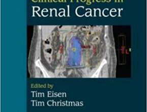 free-pdf-download-Clinical Progress in Renal Cancer