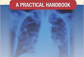 free-pdf-download-Clinical Tuberculosis: A Practical Handbook