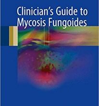 free-pdf-download-Clinician’s Guide to Mycosis Fungoides 1st ed