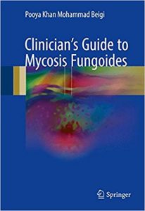 free-pdf-download-Clinician’s Guide to Mycosis Fungoides 1st ed